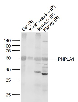 PNPLA1 Rabbit Polyclonal Antibody