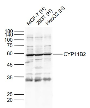 CYP11B2 Rabbit Polyclonal Antibody