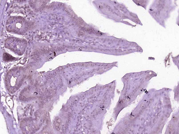ZNF408 Rabbit Polyclonal Antibody