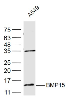 BMP15 Rabbit Polyclonal Antibody