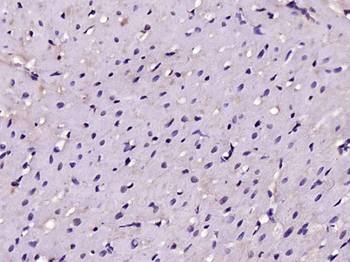 Myozenin 1 Rabbit Polyclonal Antibody