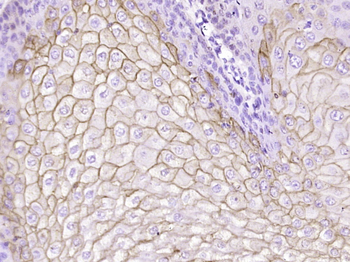 FUT4 Mouse Monoclonal Antibody