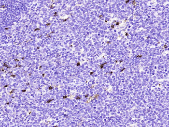 FUT4 Mouse Monoclonal Antibody