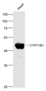 CYP11B1 Rabbit Polyclonal Antibody