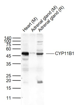CYP11B1 Rabbit Polyclonal Antibody