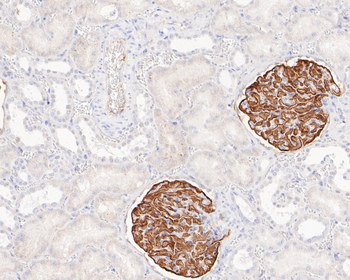 NPHS2 Recombinant Rabbit Monoclonal Antibody