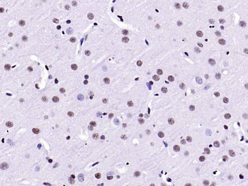 HMGB1 Rabbit Polyclonal Antibody
