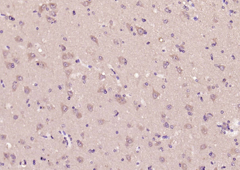 GLP-2 Rabbit Polyclonal Antibody