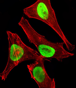 EZH2 Mouse Monoclonal Antibody