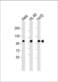 EZH2 Mouse Monoclonal Antibody