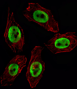 EZH2 Mouse Monoclonal Antibody