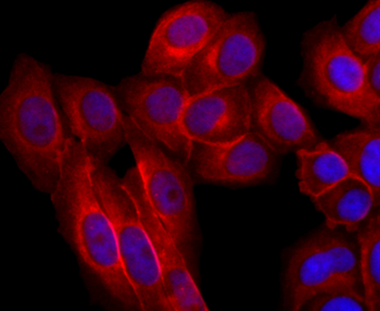 EGFR Recombinant Rabbit Monoclonal Antibody