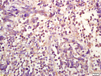 Phospho-ERK1 (Thr202/Tyr204) + ERK2 (Thr183/Tyr185) Rabbit Polyclonal Antibody