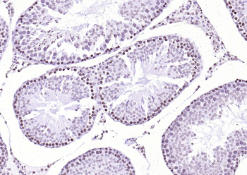 Streptavidin, HRP conjugated