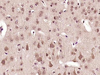 Phospho-AMPK alpha-2 (Thr172) Rabbit Polyclonal Antibody