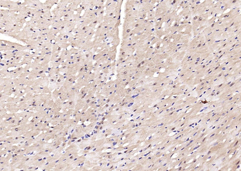 Phospho-AMPK alpha-2 (Thr172) Rabbit Polyclonal Antibody