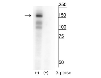 MerTK Tyr749/753/754 Antibody