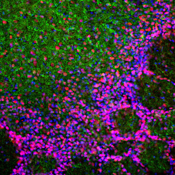 MeCP2 Antibody