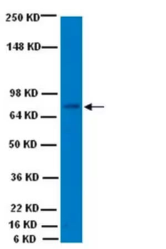 ChAT (Choline Acetyltransferase) Antibody