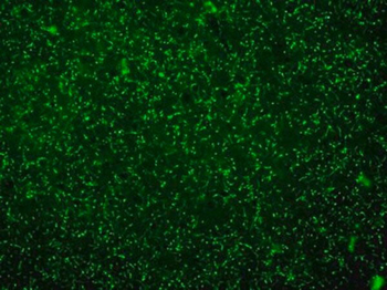 ChAT (Choline Acetyltransferase) Antibody