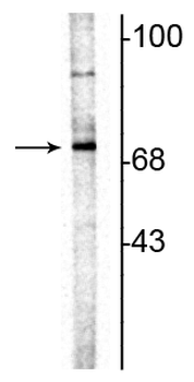 ChAT (Choline Acetyltransferase) Antibody