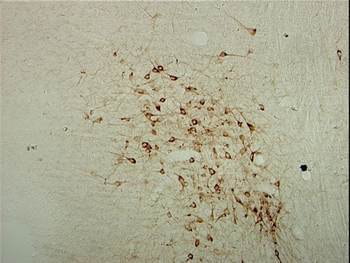 ChAT (Choline Acetyltransferase) Antibody