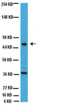 ChAT (Choline Acetyltransferase) Antibody