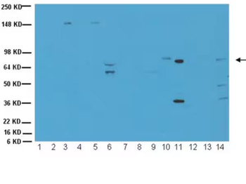 ChAT (Choline Acetyltransferase) Antibody