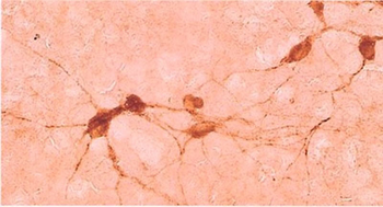 ChAT (Choline Acetyltransferase) Antibody