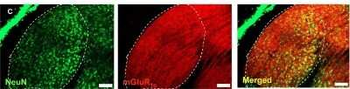 mGluR1 Antibody