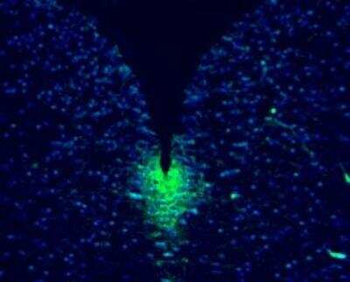 Musashi 1 Antibody