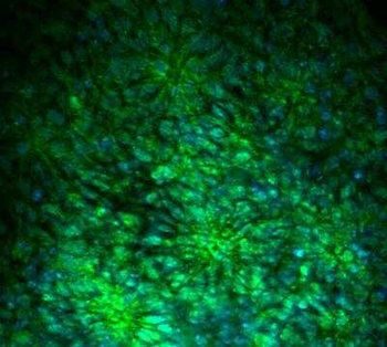 Musashi 1 Antibody