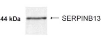 SERPINB13 Antibody