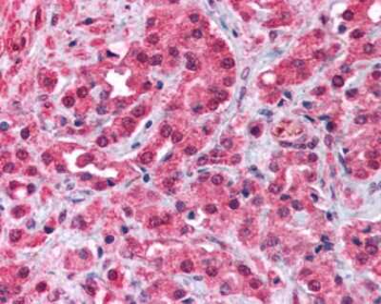 TRPM8 Antibody