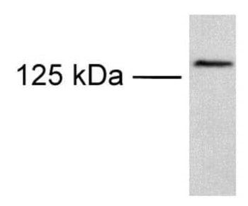 TRPM8 Antibody