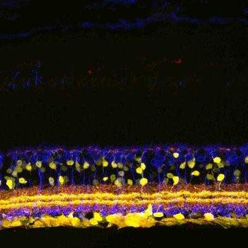 SHANK1a Antibody