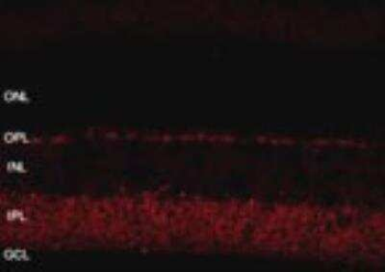 SHANK1a Antibody
