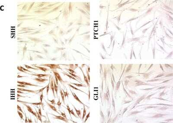 PTCH1 Antibody