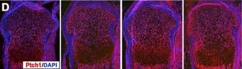 PTCH1 Antibody