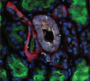 Pre-Pro-Vasopressin Antibody