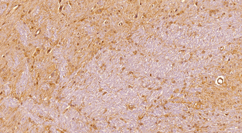NG2/CSPG4 Antibody