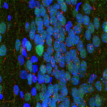 Adenylate Cyclase III Antibody