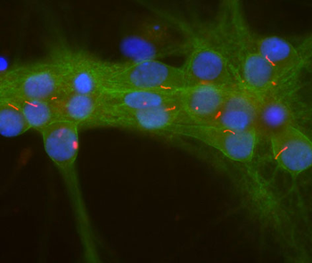 Adenylate Cyclase III Antibody