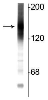 Adenylate Cyclase III Antibody