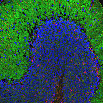 Alpha II Spectrin Antibody