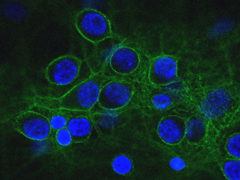 Alpha II Spectrin Antibody