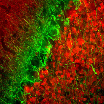 Alpha Internexin/ NF-66 Antibody