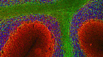 Alpha Internexin/ NF-66 Antibody