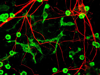 Alpha Internexin/ NF-66 Antibody