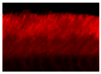 ABCA4 (Rim Protein) Antibody